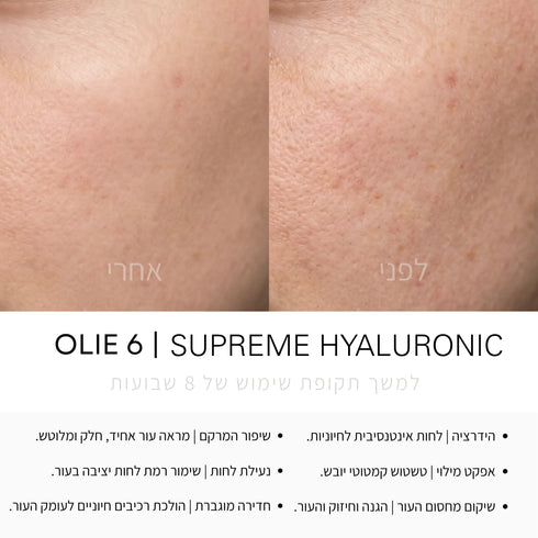 SUPREME HYALURONIC | סרום חומצה היאלורונית