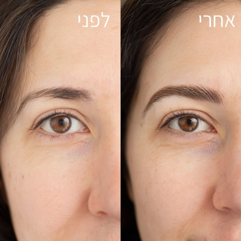 סרום להצמחת גבות