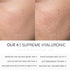 SUPREME HYALURONIC | סרום חומצה היאלורונית